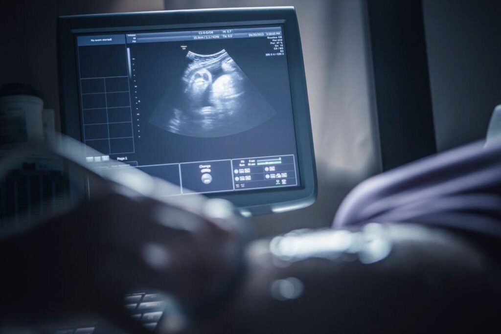 O bebê pegou todo mundo de surpresa