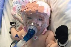 Garota de 6 meses descobre que está infectada com coronavírus depois de fazer cirurgia