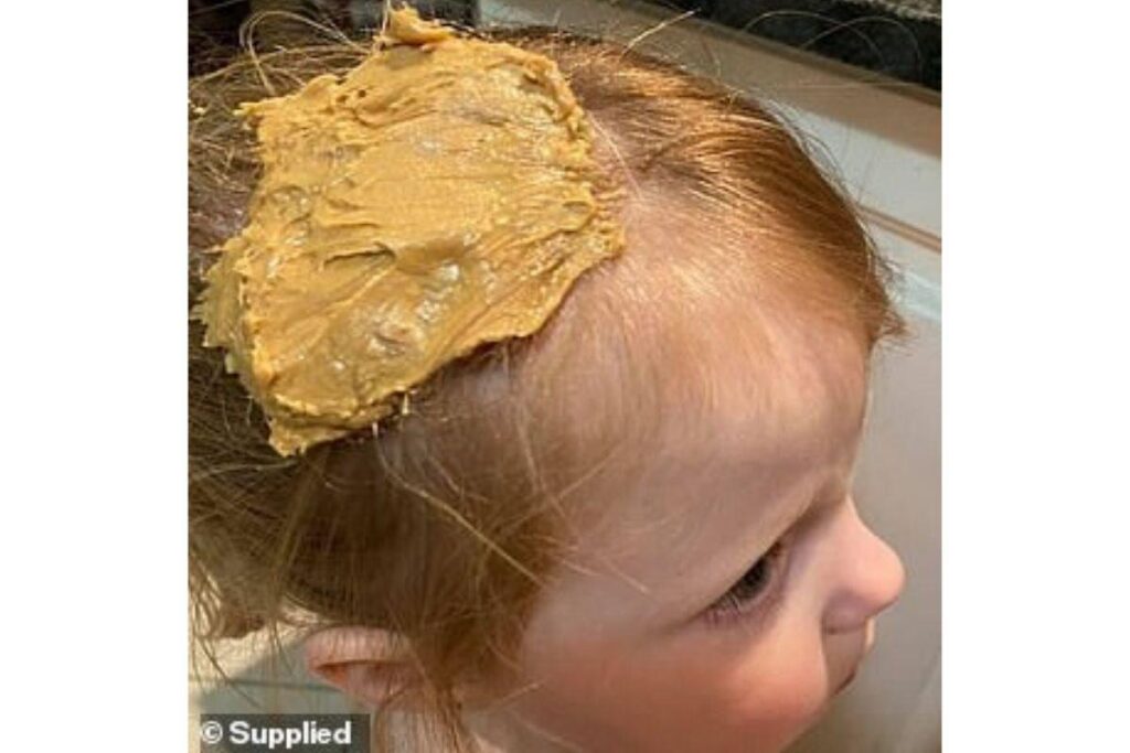 Sem desespero! Mãe descobre forma fácil e rápida de tirar chiclete do cabelo da filha