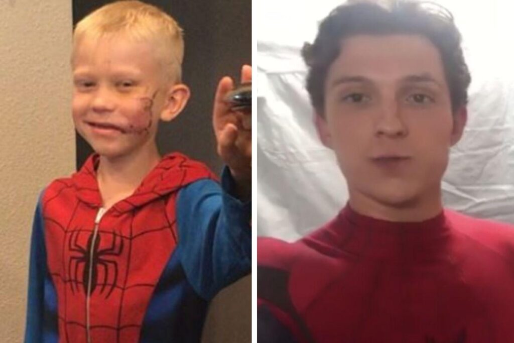 Bridger levou 90 pontos no rosto depois de salvar irmã