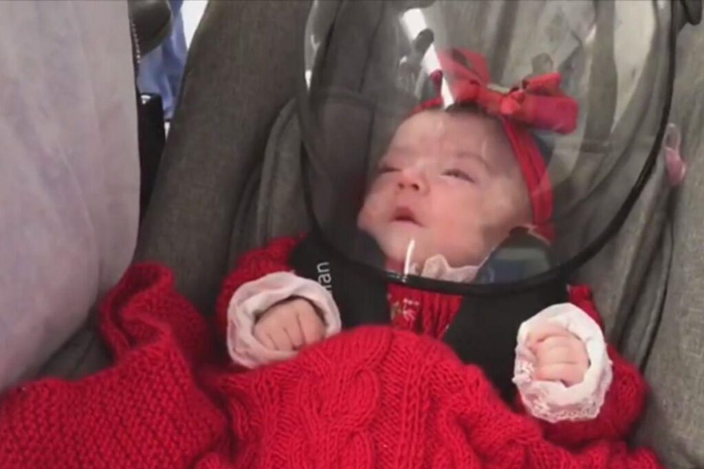 Ela ficou 5 meses internada