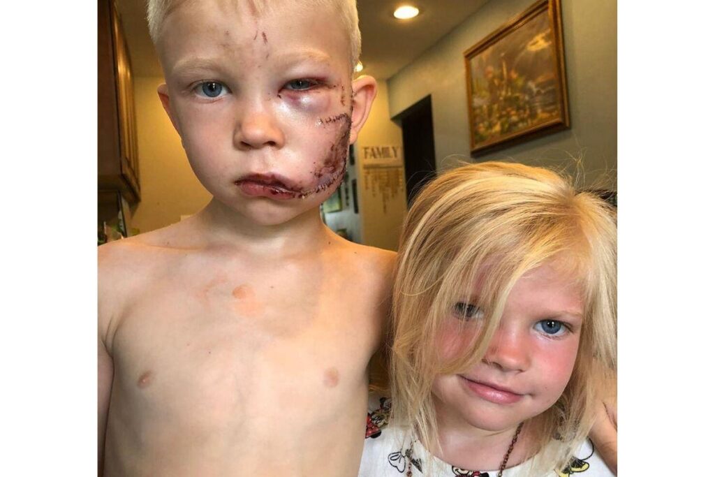 Ele salvou a irmã para não ser atacada