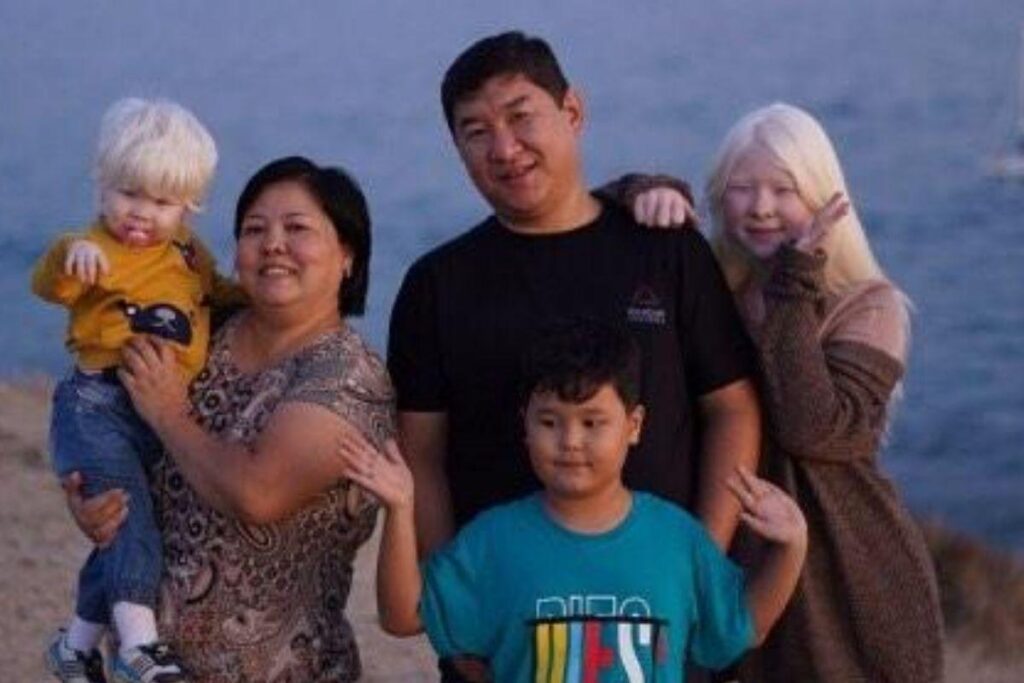 As meninas também tem um irmão, que não puxou a condição genética