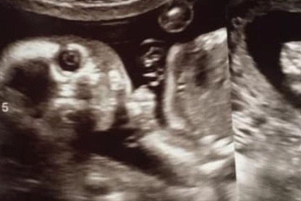 É possível ver os olhos, o nariz e os futuros dentes do bebê