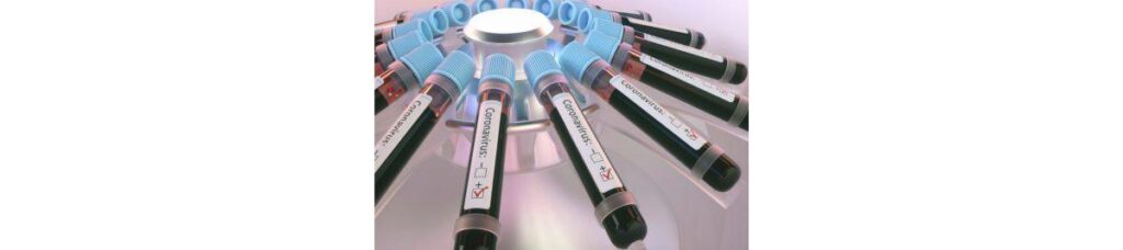 Rússia diz que vacina contra Covid-19 estará aprovada até dia 10 de agosto