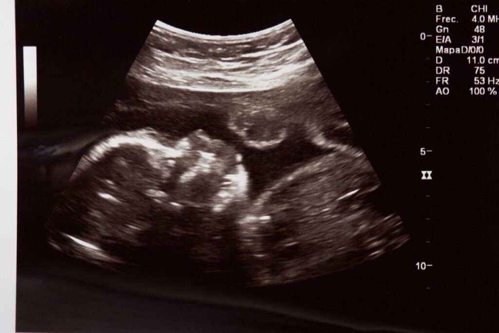 A história terminou em briga familiar