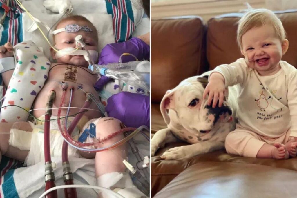 Ruby Cotter, de um ano, foi submetida a uma operação de transplante de coração de dez horas em dezembro de 2019