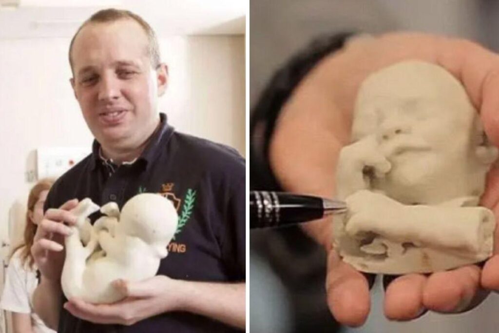 A surpresa foi preparada pela equipe médica