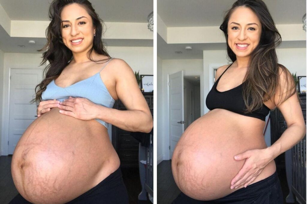 Nubbia comparou o corpo antes e depois da gestação