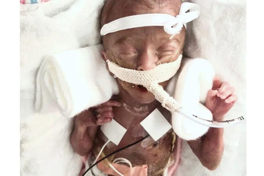 Lura sentiu constrações desde o dia anterior