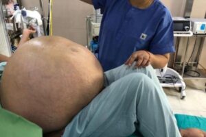 O médico e a paciente comemoraram o sucesso do procedimento