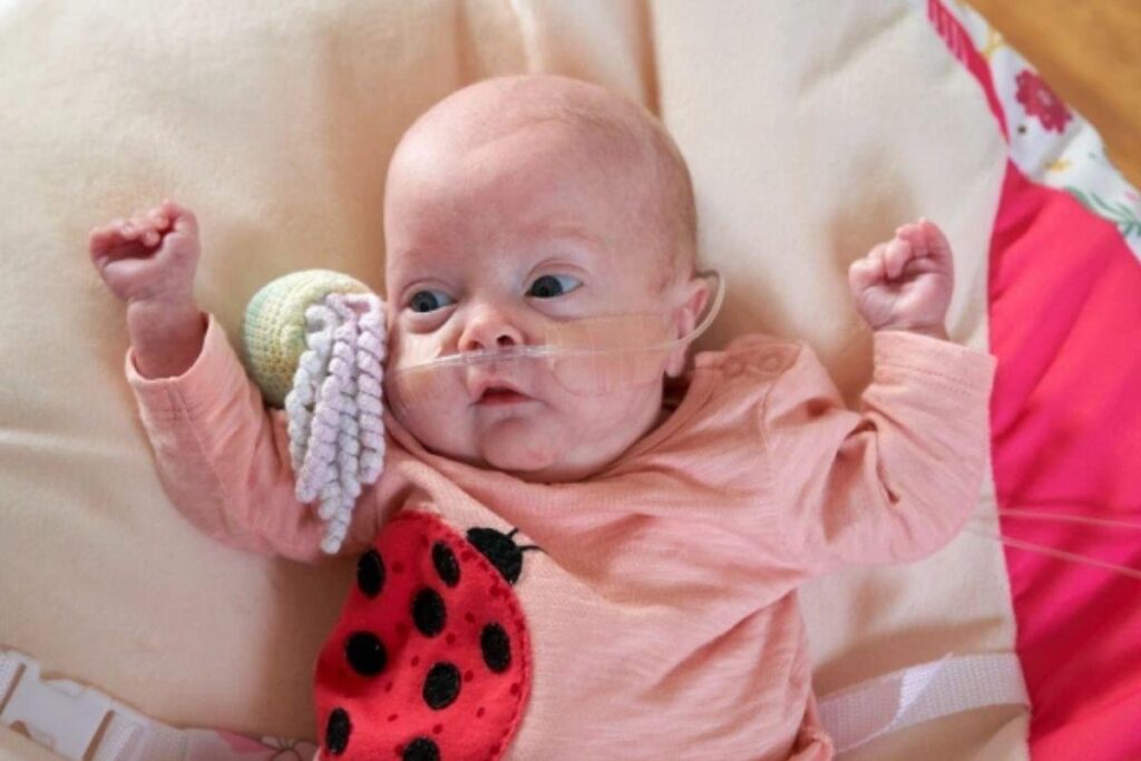 Millie nasceu com 23 semanas