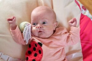 Millie nasceu com 23 semanas