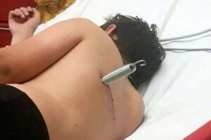 O acidente com a cama elástica aconteceu na cidade de Sheffield, no Reino Unido