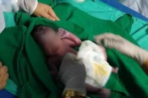 O parto aconteceu no domingo