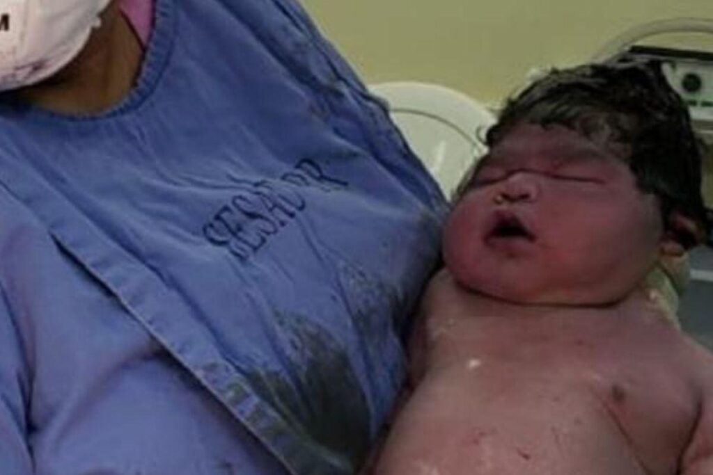 Maternidade é a única de Boa Vista