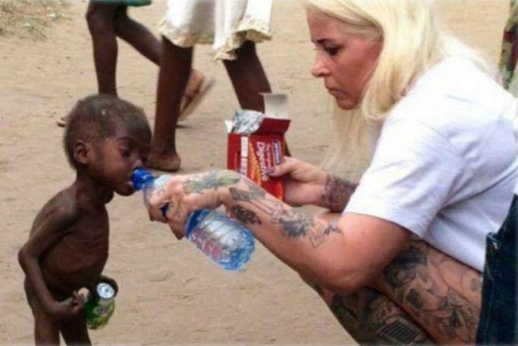 Hope foi encontrado com 2 anos desnutrido na Nigéria