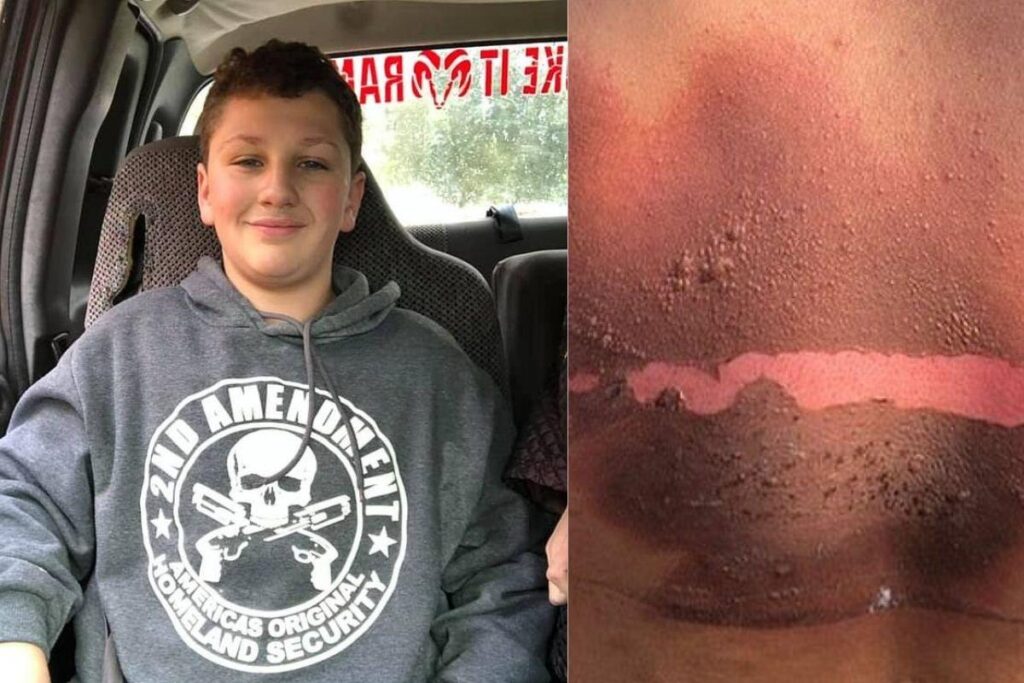 Ele estava dormindo quando as chamas começaram