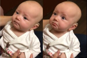De arrepiar! Vídeo mostra bebê com deficiência auditiva ouvindo os pais pela primeira vez