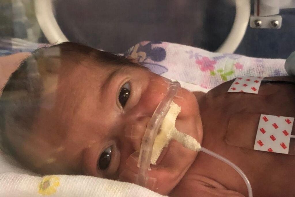 Sabrina nasceu após 27 semanas de gestação