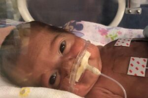 Sabrina nasceu após 27 semanas de gestação