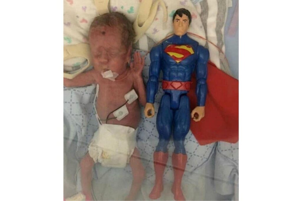 Ele nasceu após 23 semanas de gestação