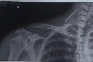 Vander tem dois filhos