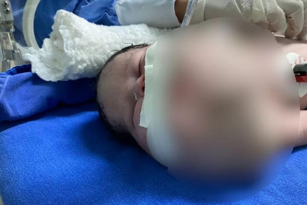A bebê está internada desde que nasceu