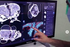 Danielle Wright antes da cirurgia