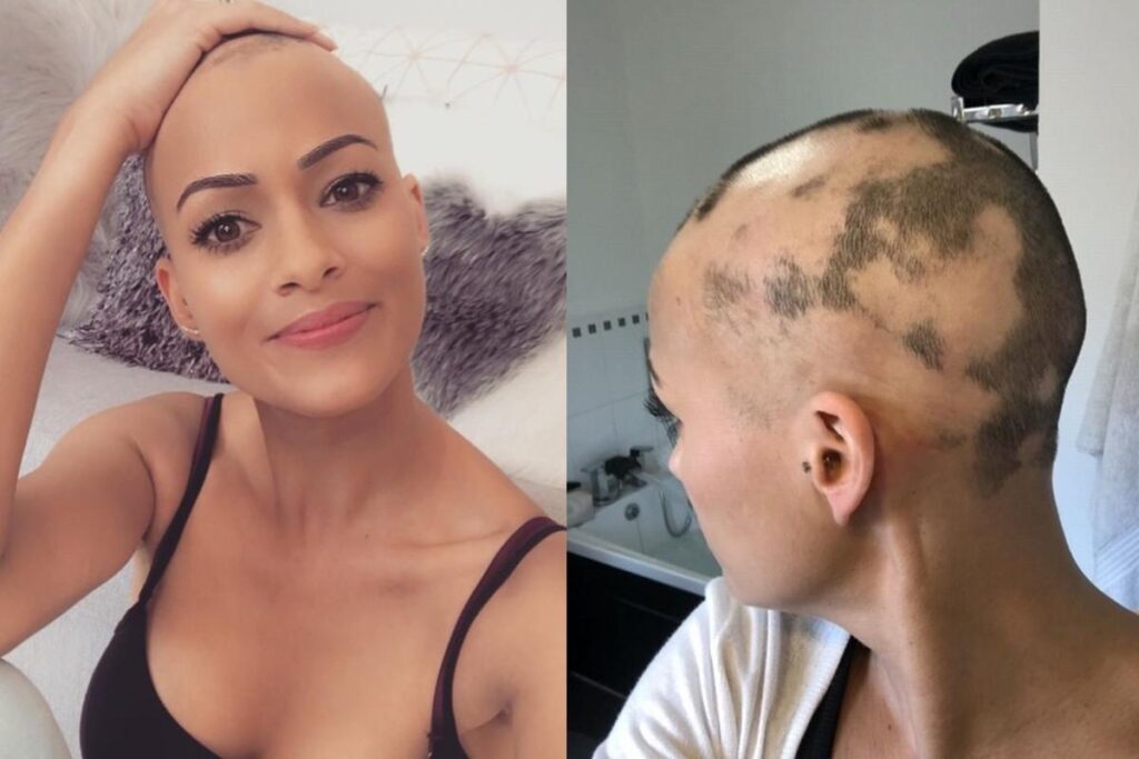 A mãe colocou o dispositivo após o nascimento da filha