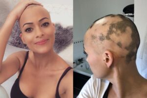 A mãe colocou o dispositivo após o nascimento da filha