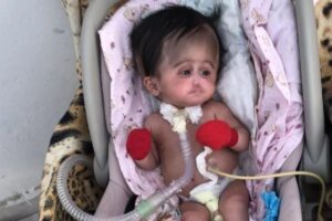 A família pede ajuda para continuar com o tratamento da filha