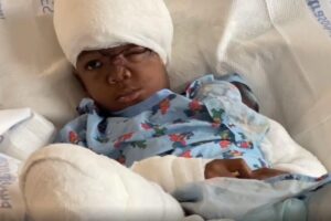 O menino segue internado desde domingo