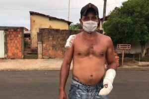 O incêndio começou no sofá