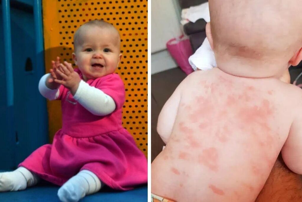 A menina está se recuperando bem