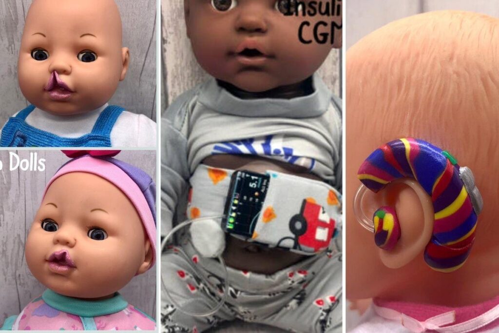 Detalhes do aparelho auditivo e implante coclear