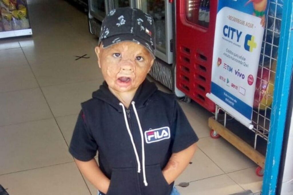 O acidente aconteceu quando o filho tinha apenas 10 meses