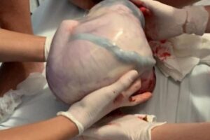 Os bebês e a mãe estão bem