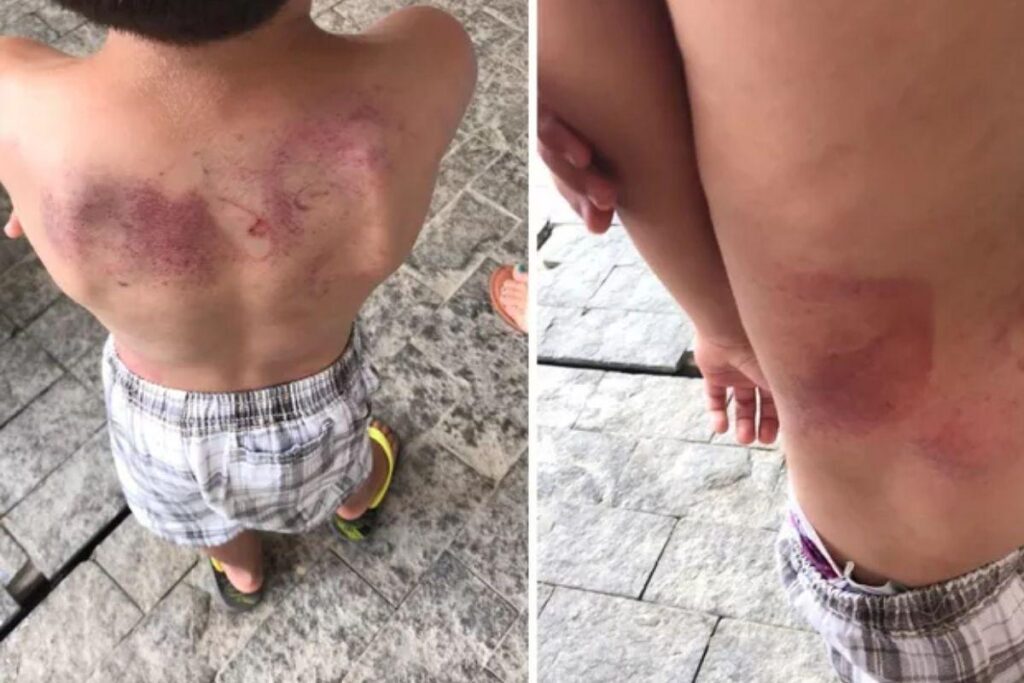 O menino está em um abrigo e aguarda a decisão judicial sobre o destino da guarda