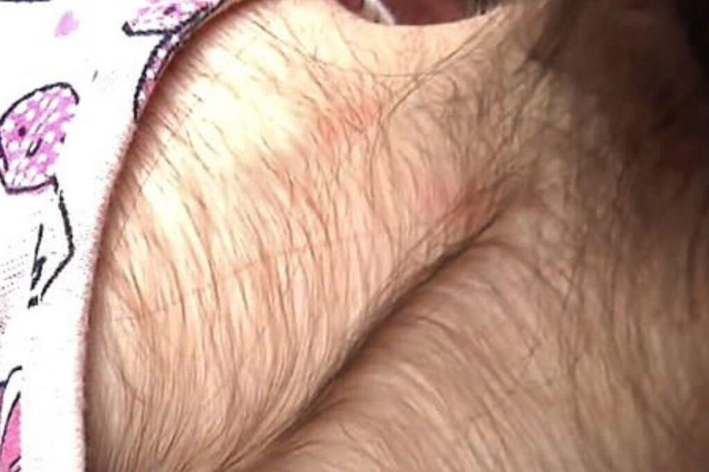 O caso aconteceu com 20 crianças