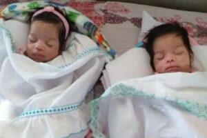 Mãe espera filhas acordarem do coma