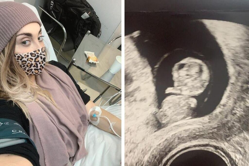 Grávida de gêmeos, mãe faz desabafo sobre aborto espontâneo de um dos bebês