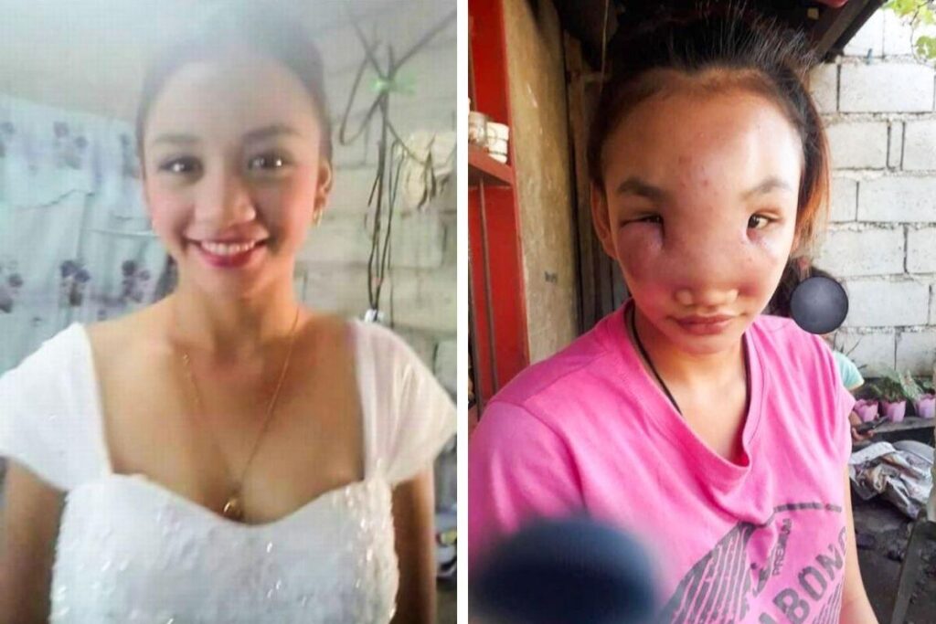 Mary achou que poderia ser apenas uma espinha inofensiva