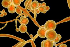 O fungo é letal e resistente a medicamentos