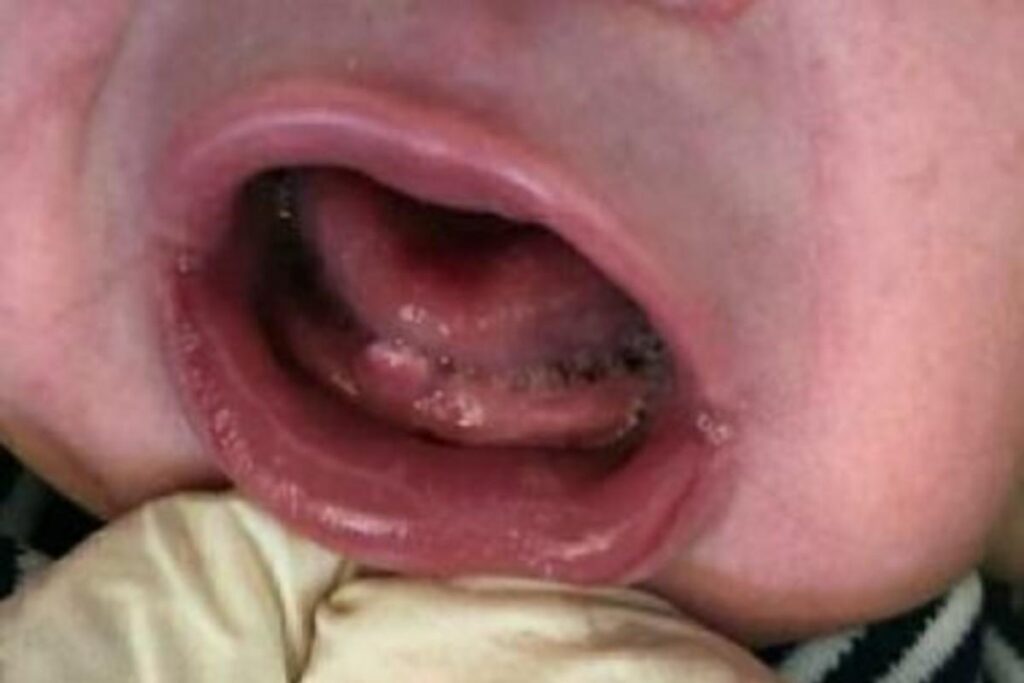 O bebê veio ao mundo na véspera do Natal