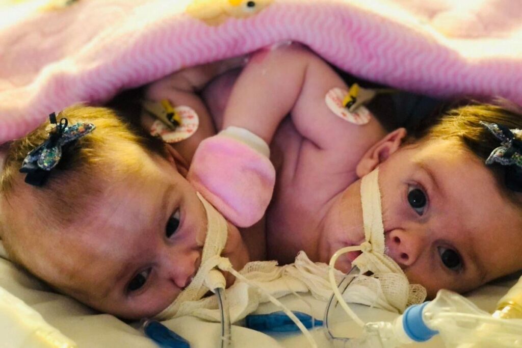 Sara e Eloá vieram ao mundo no dia 23 de setembro