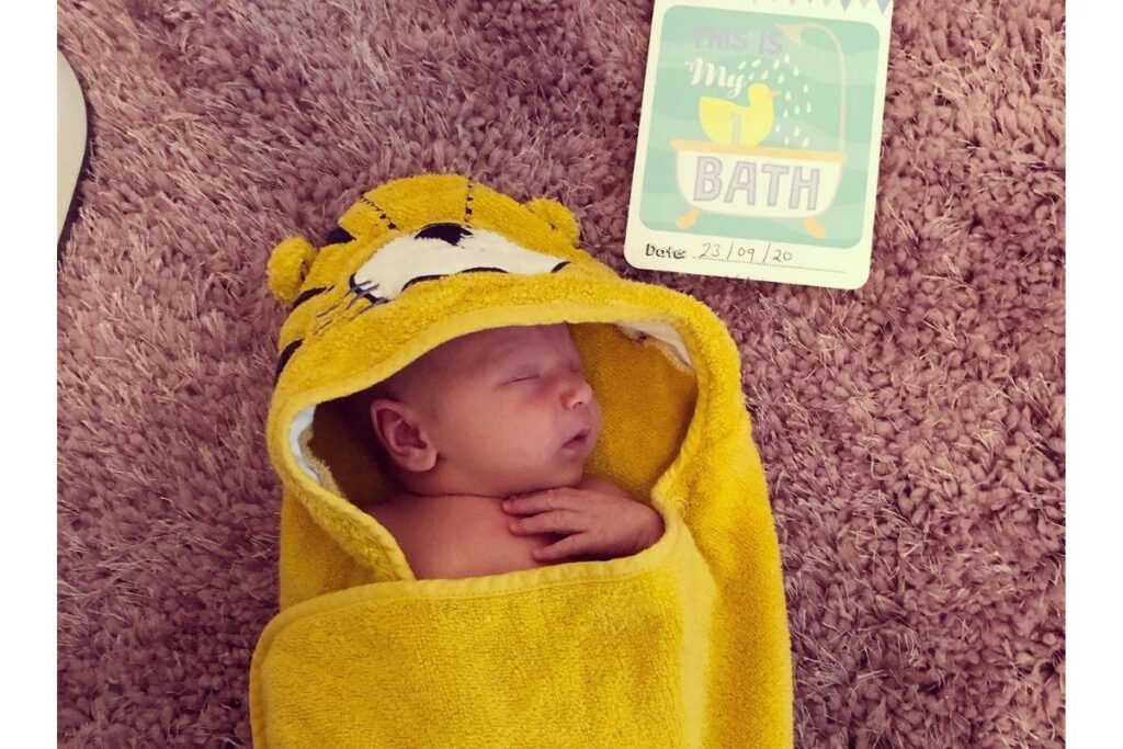 Max nasceu com gastrosquise e só tinha 5% de chance de sobreviver