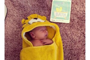 Max nasceu com gastrosquise e só tinha 5% de chance de sobreviver