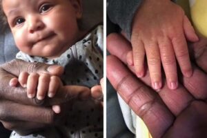 Mãe faz desabafo sobre filha que nasceu com 12 dedos