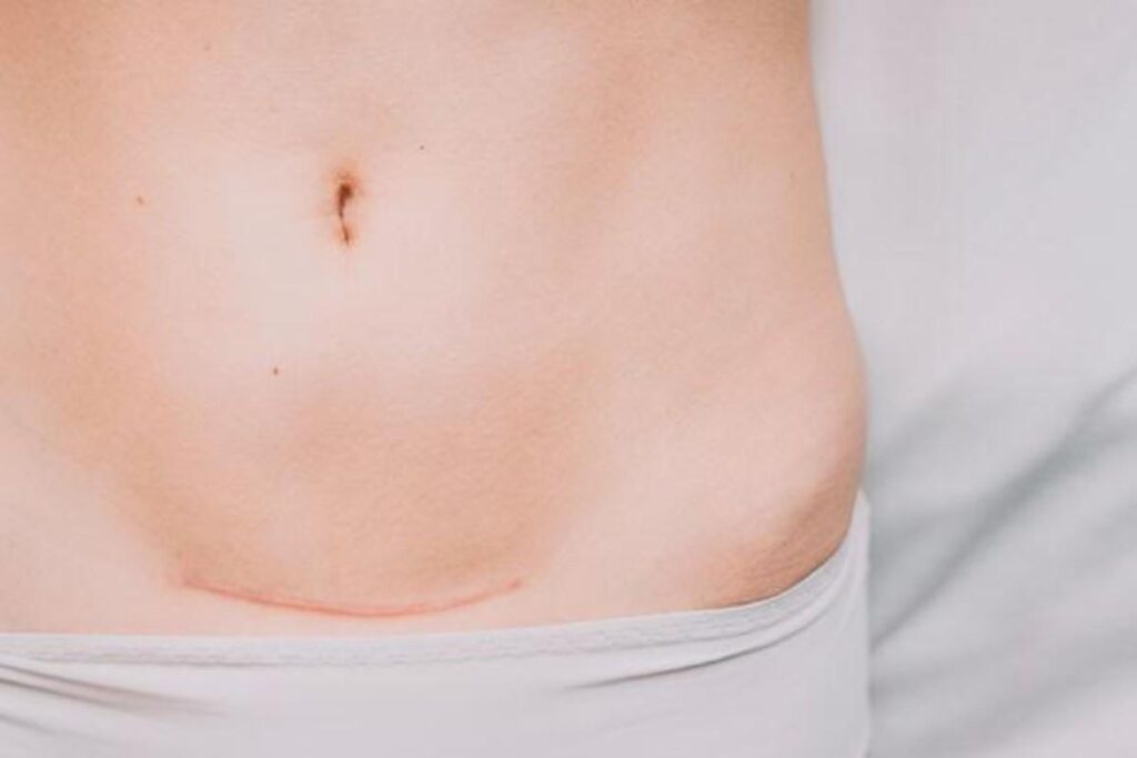 A saúde emocional das mães fica fortemente abalada